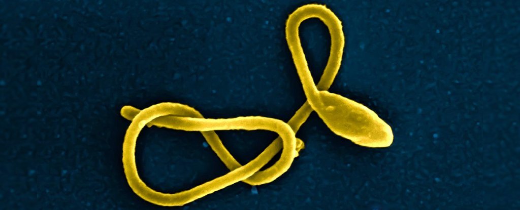 日本引入了包括埃博拉在内的5种致命病毒.jpg