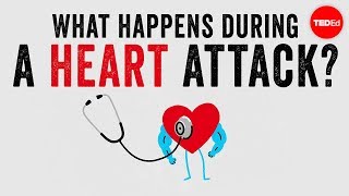 心脏病发作时会发生什么