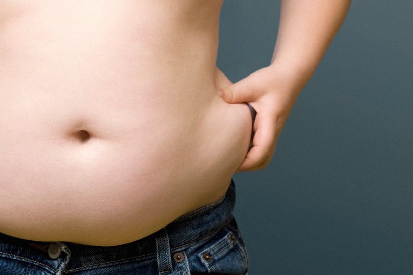 美国儿科学会呼吁为肥胖儿童做胃绕道手术.jpg