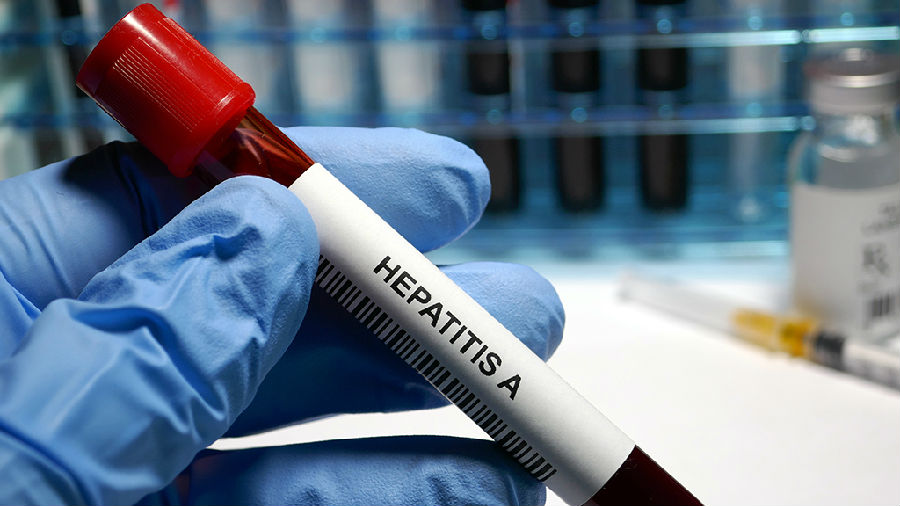 美疾控中心发警告 提醒留意不明儿童肝炎